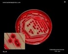klebsiella pneumoniae appearance on Endo agar